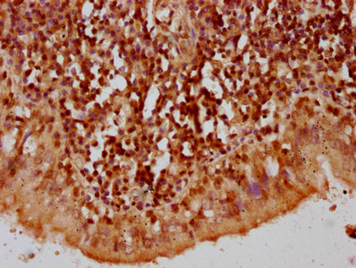 HIST1H2AI Antibody - Immunohistochemistry Dilution at 1:10 and staining in paraffin-embedded human lung tissue performed on a Leica BondTM system. After dewaxing and hydration, antigen retrieval was mediated by high pressure in a citrate buffer (pH 6.0). Section was blocked with 10% normal Goat serum 30min at RT. Then primary antibody (1% BSA) was incubated at 4°C overnight. The primary is detected by a biotinylated Secondary antibody and visualized using an HRP conjugated SP system.