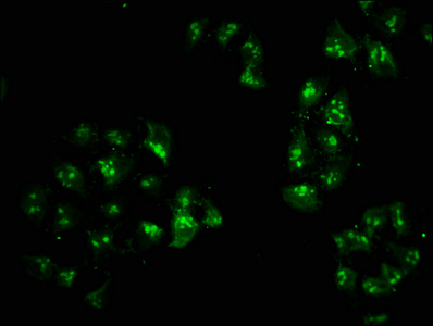 HIST1H2AI Antibody - Immunofluorescence staining of Hela cells with HIST1H2AG (Ab-119) Antibody at 1:5, counter-stained with DAPI. The cells were fixed in 4% formaldehyde, permeabilized using 0.2% Triton X-100 and blocked in 10% normal Goat Serum. The cells were then incubated with the antibody overnight at 4°C. The secondary antibody was Alexa Fluor 488-congugated AffiniPure Goat Anti-Rabbit IgG(H+L).