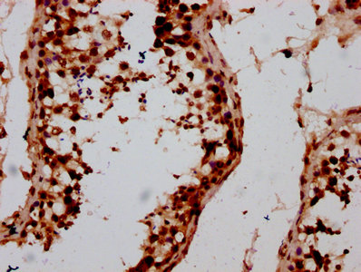 HIST1H2AI Antibody - Immunohistochemistry Dilution at 1:10 and staining in paraffin-embedded human testis tissue performed on a Leica BondTM system. After dewaxing and hydration, antigen retrieval was mediated by high pressure in a citrate buffer (pH 6.0). Section was blocked with 10% normal Goat serum 30min at RT. Then primary antibody (1% BSA) was incubated at 4°C overnight. The primary is detected by a biotinylated Secondary antibody and visualized using an HRP conjugated SP system.
