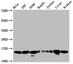 HIST1H2AI Antibody - Western Blot Positive WB detected in: Hela whole cell lysate, 293 whole cell lysate, A549 whole cell lysate, HepG2 whole cell lysate, Jurkat whole cell lysate, Rat liver tissue, Rat kidney tissue All Lanes: HIST1H2AG antibody at 0.21µg/ml Secondary Goat polyclonal to rabbit IgG at 1/50000 dilution Predicted band size: 15 KDa Observed band size: 15 KDa
