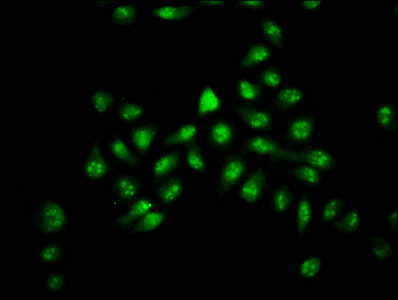 HIST1H2AI Antibody - Immunofluorescence staining of Hela cells with HIST1H2AG (Ab-5) Antibody, counter-stained with DAPI. The cells were fixed in 4% formaldehyde, permeabilized using 0.2% Triton X-100 and blocked in 10% normal Goat Serum. The cells were then incubated with the antibody overnight at 4°C. The secondary antibody was Alexa Fluor 488-congugated AffiniPure Goat Anti-Rabbit IgG(H+L).