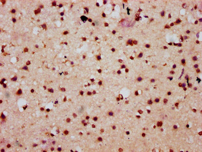 HIST1H2AI Antibody - Immunohistochemistry Dilution at 1:10 and staining in paraffin-embedded human brain tissue performed on a Leica BondTM system. After dewaxing and hydration, antigen retrieval was mediated by high pressure in a citrate buffer (pH 6.0). Section was blocked with 10% normal Goat serum 30min at RT. Then primary antibody (1% BSA) was incubated at 4°C overnight. The primary is detected by a biotinylated Secondary antibody and visualized using an HRP conjugated SP system.