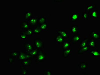 HIST1H2AI Antibody - Immunofluorescence staining of Hela cells with HIST1H2AG (Ab-9) Antibody, counter-stained with DAPI. The cells were fixed in 4% formaldehyde, permeabilized using 0.2% Triton X-100 and blocked in 10% normal Goat Serum. The cells were then incubated with the antibody overnight at 4°C. The secondary antibody was Alexa Fluor 488-congugated AffiniPure Goat Anti-Rabbit IgG(H+L).