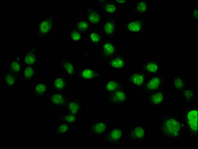 HIST1H2AI Antibody - Immunofluorescence staining of Hela cells diluted at 4°C.The Secondary antibody was Alexa Fluor 488-congugated AffiniPure Goat Anti-Rabbit IgG (H+L).
