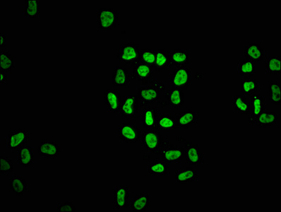 HIST1H2AI Antibody - Immunofluorescence staining of Hela cells with Histone H2A (Ab-5) Antibody at 1:1.5, counter-stained with DAPI. The cells were fixed in 4% formaldehyde, permeabilized using 0.2% Triton X-100 and blocked in 10% normal Goat Serum. The cells were then incubated with the antibody overnight at 4°C. The secondary antibody was Alexa Fluor 488-congugated AffiniPure Goat Anti-Rabbit IgG(H+L).