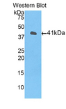 HIST1H2AJ Antibody - Western blot of recombinant HIST1H2AJ.  This image was taken for the unconjugated form of this product. Other forms have not been tested.