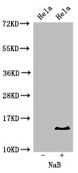 HIST1H2BB Antibody - Positive Western Blot detected in Hela cell acid extracts treated by NaB. All lanes: HIST1H2BB antibody at 2 µg/ml Secondary Goat polyclonal to rabbit IgG at 1/50000 dilution. Predicted band size: 14 KDa. Observed band size: 14 KDa