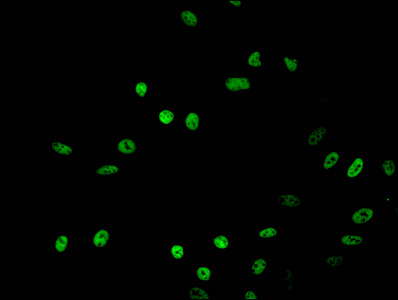 HIST1H2BB Antibody - Immunofluorescent analysis of Hela cells treated with NaB at a dilution of 1:100 and Alexa Fluor 488-congugated AffiniPure Goat Anti-Rabbit IgG(H+L)