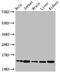 HIST1H2BB Antibody - Positive Western Blot detected in Hela cell acid extracts, Jurkat cell acid extracts, Mouse brain tissue, Mouse liver tissue, Mouse kidney tissue. All lanes: HIST1H2BB antibody at 2.5 µg/ml Secondary Goat polyclonal to rabbit IgG at 1/50000 dilution. Predicted band size: 14 KDa. Observed band size: 14 KDa
