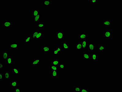 HIST1H2BB Antibody - Immunofluorescence staining of Hela cells (treated by 15mM sodium butyrate for 30min) diluted at 1:84,counter-stained with DAPI. The cells were fixed in 4% formaldehyde, permeabilized using 0.2% Triton X-100 and blocked in 10% normal Goat Serum. The cells were then incubated with the antibody overnight at 4°C.The Secondary antibody was Alexa Fluor 488-congugated AffiniPure Goat Anti-Rabbit IgG (H+L).