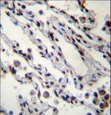 HIST1H2BN Antibody - HIST1H2BN Antibody immunohistochemistry of formalin-fixed and paraffin-embedded human lung tissue followed by peroxidase-conjugated secondary antibody and DAB staining.