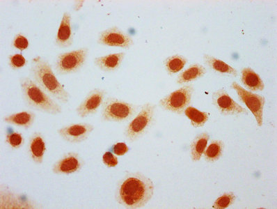 HIST1H2BN Antibody - Immunocytochemistry analysis diluted at 1:25 and staining in Hela cells(treated with 30mM sodium butyrate for 4h) performed on a Leica BondTM system. The cells were fixed in 4% formaldehyde, permeabilized using 0.2% Triton X-100 and blocked with 10% normal Goat serum 30min at RT. Then primary antibody (1% BSA) was incubated at 4°C overnight. The primary is detected by a biotinylated Secondary antibody and visualized using an HRP conjugated SP system.