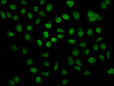 HIST1H2BN Antibody - Immunofluorescence staining of Hela cells (treated with 30mM sodium butyrate for 4h) diluted at 1:12.5, counter-stained with DAPI. The cells were fixed in 4% formaldehyde, permeabilized using 0.2% Triton X-100 and blocked in 10% normal Goat Serum. The cells were then incubated with the antibody overnight at 4°C.The Secondary antibody was Alexa Fluor 488-congugated AffiniPure Goat Anti-Rabbit IgG (H+L) .