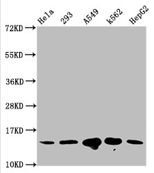 HIST1H2BN Antibody - Western Blot Positive WB detected in: Hela whole cell lysate, 293 whole cell lysate, A549 whole cell lysate, K562 whole cell lysate, HepG2 whole cell lysate(all treated with 30mM sodium butyrate for 4h) All Lanes: HIST1H2BC antibody at 1.2µg/ml Secondary Goat polyclonal to rabbit IgG at 1/50000 dilution Predicted band size: 14 KDa Observed band size: 14 KDa