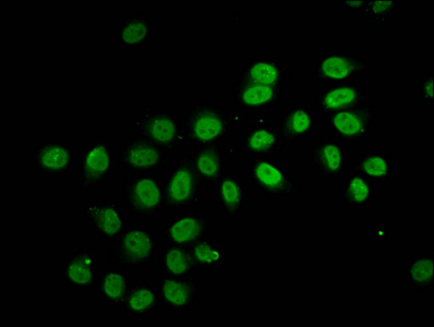 HIST1H2BN Antibody - Immunofluorescence staining of Hela cells (treated with 30mM sodium butyrate for 4h) diluted at 1:7.5, counter-stained with DAPI. The cells were fixed in 4% formaldehyde, permeabilized using 0.2% Triton X-100 and blocked in 10% normal Goat Serum. The cells were then incubated with the antibody overnight at 4°C.The Secondary antibody was Alexa Fluor 488-congugated AffiniPure Goat Anti-Rabbit IgG (H+L) .