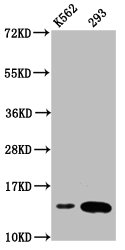 HIST1H2BN Antibody - Western Blot Positive WB detected in: K562 whole cell lysate, 293 whole cell lysate(all treated with 30mM sodium butyrate for 4h) All Lanes: HIST1H2BC antibody at 1.85µg/ml Secondary Goat polyclonal to rabbit IgG at 1/50000 dilution Predicted band size: 14 KDa Observed band size: 14 KDa