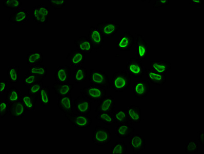 HIST1H2BN Antibody - Immunofluorescence staining of Hela cells (treated with 30mM sodium butyrate for 4h) diluted at 1:5, counter-stained with DAPI. The cells were fixed in 4% formaldehyde, permeabilized using 0.2% Triton X-100 and blocked in 10% normal Goat Serum. The cells were then incubated with the antibody overnight at 4°C.The Secondary antibody was Alexa Fluor 488-congugated AffiniPure Goat Anti-Rabbit IgG (H+L) .