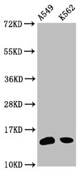HIST1H2BN Antibody - Western Blot Positive WB detected in: A549 whole cell lysate, K562 whole cell lysate(all treated with 30mM sodium butyrate for 4h) All Lanes: HIST1H2BC antibody at 1.2µg/ml Secondary Goat polyclonal to rabbit IgG at 1/50000 dilution Predicted band size: 14 KDa Observed band size: 14 KDa