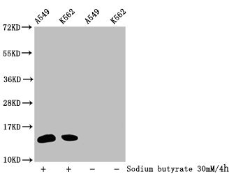 HIST1H2BN Antibody - Western Blot Detected samples: A549 whole cell lysate, K562 whole cell lysate; Untreated (-) or treated (+) with 30mM sodium butyrate for 4h All lanes: HIST1H2BC antibody at 1:100 Secondary Goat polyclonal to rabbit IgG at 1/50000 dilution Predicted band size: 14 kDa Observed band size: 14 kDa