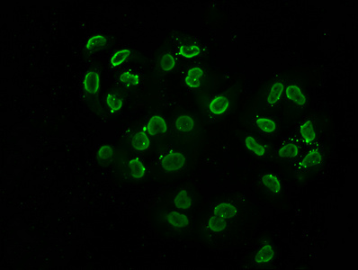 HIST1H2BN Antibody - Immunofluorescence staining of Hela cells (treated with 30mM sodium butyrate for 4h) diluted at 1:2.5, counter-stained with DAPI. The cells were fixed in 4% formaldehyde, permeabilized using 0.2% Triton X-100 and blocked in 10% normal Goat Serum. The cells were then incubated with the antibody overnight at 4°C.The Secondary antibody was Alexa Fluor 488-congugated AffiniPure Goat Anti-Rabbit IgG (H+L) .