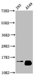 HIST1H2BN Antibody - Western Blot Positive WB detected in: 293 whole cell lysate, A549 whole cell lysate(treated with 30mM sodium butyrate for 4h) All Lanes: HIST1H2BC antibody at 1.29µg/ml Secondary Goat polyclonal to rabbit IgG at 1/50000 dilution Predicted band size: 14 KDa Observed band size: 14 KDa