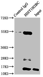 HIST1H2BN Antibody - Immunoprecipitating HIST1H2BC in HepG2 whole cell lysate (treated with 30mM sodium butyrate for 4h) Lane 1: Rabbit control IgG instead of Acetyl-HIST1H2BC (K15) Antibody in HepG2 whole cell lysate (treated with 30mM sodium butyrate for 4h).For western blotting, a HRP-conjugated Protein G antibody was used as the secondary antibody (1/2000) Lane 2: Acetyl-HIST1H2BC (K15) Antibody (5µg) + HepG2 whole cell lysate (treated with 30mM sodium butyrate for 4h)500µg) Lane 3: HepG2 whole cell lysate (treated with 30mM sodium butyrate for 4h) (20µg)