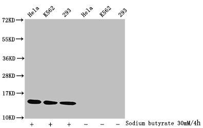 HIST1H2BN Antibody - Western Blot Detected samples: Hela whole cell lysate, K562 whole cell lysate, 293 whole cell lysate; Untreated (-) or treated (+) with 30mM sodium butyrate for 4h All lanes: HIST1H2BC antibody at 1:1000 Secondary Goat polyclonal to rabbit IgG at 1/40000 dilution Predicted band size: 14 kDa Observed band size: 14 kDa
