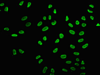 HIST1H2BN Antibody - Immunofluorescence staining of Hela cells (treated with 30mM sodium butyrate for 4h) with Acetyl-HIST1H2BC (K15) Antibody at 1:5, counter-stained with DAPI. The cells were fixed in 4% formaldehyde, permeabilized using 0.2% Triton X-100 and blocked in 10% normal Goat Serum. The cells were then incubated with the antibody overnight at 4°C. The secondary antibody was Alexa Fluor 488-congugated AffiniPure Goat Anti-Rabbit IgG(H+L).