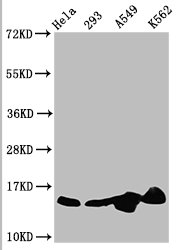 HIST1H2BN Antibody - Western Blot Positive WB detected in: Hela whole cell lysate, 293 whole cell lysate, A549 whole cell lysate, K562 whole cell lysate(all treated with 30mM sodium butyrate for 4h) All Lanes: HIST1H2BC antibody at 1.25µg/ml Secondary Goat polyclonal to rabbit IgG at 1/50000 dilution Predicted band size: 14 KDa Observed band size: 14 KDa