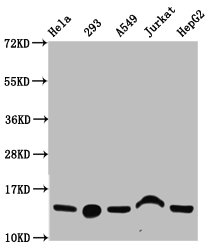 HIST1H2BN Antibody - Western Blot Positive WB detected in: Hela whole cell lysate, 293 whole cell lysate, A549 whole cell lysate, Jurkat whole cell lysate, HepG2 whole cell lysate(all treated with 30mM sodium butyrate for 4h) All Lanes: HIST1H2BC antibody at 1.35µg/ml Secondary Goat polyclonal to rabbit IgG at 1/50000 dilution Predicted band size: 14 KDa Observed band size: 14 KDa