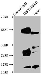 HIST1H2BN Antibody - Immunoprecipitating HIST1H2BC in A549 whole cell lysate Lane 1: Rabbit control IgG instead of Acetyl-HIST1H2BC (K24) Antibody in A549 whole cell lysate.For western blotting, a HRP-conjugated Protein G antibody was used as the secondary antibody (1/2000) Lane 2: Acetyl-HIST1H2BC (K24) Antibody (5µg) + A549 whole cell lysate (500µg) Lane 3: A549 whole cell lysate (20µg)