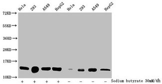 HIST1H2BN Antibody - Western Blot Detected samples: Hela whole cell lysate, 293 whole cell lysate, A549 whole cell lysate, HepG2 whole cell lysate; Untreated (-) or treated (+) with 30mM sodium butyrate for 4h All lanes: HIST1H2BC antibody at 1:100 Secondary Goat polyclonal to rabbit IgG at 1/50000 dilution Predicted band size: 14 kDa Observed band size: 14 kDa
