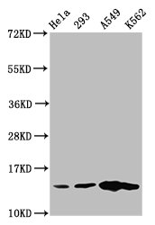 HIST1H2BN Antibody - Western Blot Positive WB detected in: Hela whole cell lysate, 293 whole cell lysate, A549 whole cell lysate, K562 whole cell lysate(all treated with 30mM sodium butyrate for 4h) All Lanes: HIST1H2BC antibody at 1.3µg/ml Secondary Goat polyclonal to rabbit IgG at 1/50000 dilution Predicted band size: 14 KDa Observed band size: 14 KDa