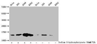 HIST1H2BN Antibody - Western Blot Detected samples: Hela whole cell lysate, 293 whole cell lysate, A549 whole cell lysate, K562 whole cell lysate; Untreated (-) or treated (+) with 50mM Sodium 3-hydroxybutyrate for 72h All lanes: HIST1H2BC antibody at 1:100 Secondary Goat polyclonal to rabbit IgG at 1/50000 dilution Predicted band size: 14 kDa Observed band size: 14 kDa