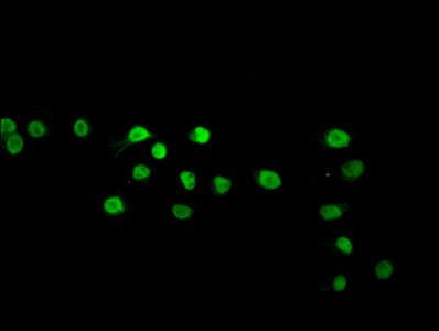 HIST1H2BN Antibody - Immunofluorescence staining of Hela cells (treated with 50mM sodium 3-hydroxybutyrate for 72h) diluted at 1:10, counter-stained with DAPI. The cells were fixed in 4% formaldehyde, permeabilized using 0.2% Triton X-100 and blocked in 10% normal Goat Serum. The cells were then incubated with the antibody overnight at 4°C.The Secondary antibody was Alexa Fluor 488-congugated AffiniPure Goat Anti-Rabbit IgG (H+L) .