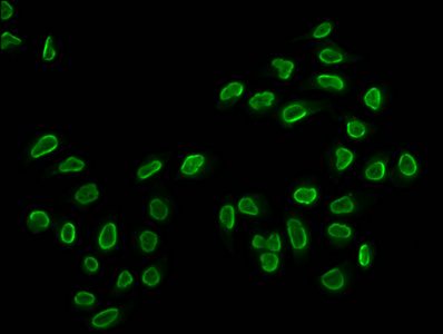 HIST1H2BN Antibody - Immunofluorescence staining of Hela cells (treated with 30mM sodium butyrate for 4h) diluted at 1:15, counter-stained with DAPI. The cells were fixed in 4% formaldehyde, permeabilized using 0.2% Triton X-100 and blocked in 10% normal Goat Serum. The cells were then incubated with the antibody overnight at 4°C.The Secondary antibody was Alexa Fluor 488-congugated AffiniPure Goat Anti-Rabbit IgG (H+L) .