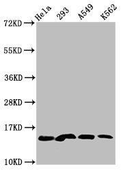 HIST1H2BN Antibody - Western Blot Positive WB detected in: Hela whole cell lysate, 293 whole cell lysate, A549 whole cell lysate, K562 whole cell lysate(all treated with 30mM sodium crotonylate for 4h) All Lanes: HIST1H2BC antibody at 1.6µg/ml Secondary Goat polyclonal to rabbit IgG at 1/50000 dilution Predicted band size: 14 KDa Observed band size: 14 KDa