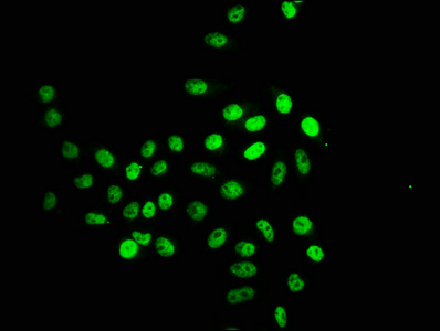 HIST1H2BN Antibody - Immunofluorescence staining of Hela cells (treated with 30mM sodium crotonylate for 4h) with Crotonyl-HIST1H2BC (K16) Antibody at 12.5, counter-stained with DAPI. The cells were fixed in 4% formaldehyde, permeabilized using 0.2% Triton X-100 and blocked in 10% normal Goat Serum. The cells were then incubated with the antibody overnight at 4°C. The secondary antibody was Alexa Fluor 488-congugated AffiniPure Goat Anti-Rabbit IgG(H+L).
