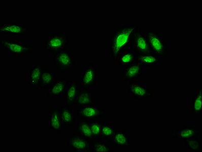 HIST1H2BN Antibody - Immunofluorescence staining of Hela cells (treated with 30mM sodium crotonylate for 4h) with Crotonyl-HIST1H2BC (K20) Antibody at 1:12.5, counter-stained with DAPI. The cells were fixed in 4% formaldehyde, permeabilized using 0.2% Triton X-100 and blocked in 10% normal Goat Serum. The cells were then incubated with the antibody overnight at 4°C. The secondary antibody was Alexa Fluor 488-congugated AffiniPure Goat Anti-Rabbit IgG(H+L).