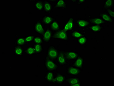 HIST1H2BN Antibody - Immunofluorescence staining of Hela cells (treated with 30mM sodium butyrate for 4h) diluted at 4°C.The Secondary antibody was Alexa Fluor 488-congugated AffiniPure Goat Anti-Rabbit IgG (H+L) .