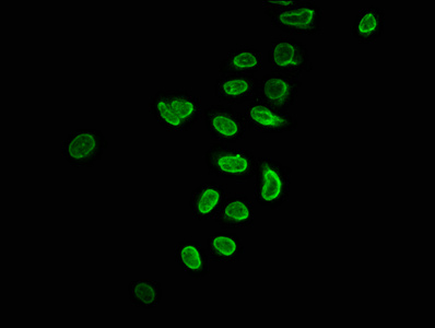 HIST1H2BN Antibody - Immunofluorescence staining of Hela cells (treated with 30mM sodium butyrate for 4h) with Glutaryl-HIST1H2BC (K116) Antibody at 1:5, counter-stained with DAPI. The cells were fixed in 4% formaldehyde, permeabilized using 0.2% Triton X-100 and blocked in 10% normal Goat Serum. The cells were then incubated with the antibody overnight at 4°C. The secondary antibody was Alexa Fluor 488-congugated AffiniPure Goat Anti-Rabbit IgG(H+L).
