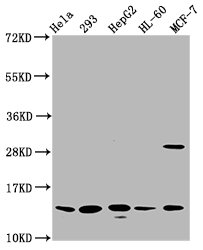 HIST1H2BN Antibody - Western Blot Positive WB detected in: Hela whole cell lysate, 293 whole cell lysate, HepG2 whole cell lysate, HL-60 whole cell lysate, MCF-7 whole cell lysate All Lanes: HIST1H2BC antibody at 0.79µg/ml Secondary Goat polyclonal to rabbit IgG at 1/50000 dilution Predicted band size: 14 KDa Observed band size: 14 KDa