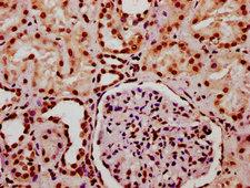 HIST1H2BN Antibody - Immunohistochemistry Dilution at 1:20 and staining in paraffin-embedded human kidney tissue performed on a Leica BondTM system. After dewaxing and hydration, antigen retrieval was mediated by high pressure in a citrate buffer (pH 6.0). Section was blocked with 10% normal Goat serum 30min at RT. Then primary antibody (1% BSA) was incubated at 4°C overnight. The primary is detected by a biotinylated Secondary antibody and visualized using an HRP conjugated SP system.