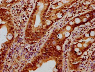 HIST1H2BN Antibody - Immunohistochemistry Dilution at 1:10 and staining in paraffin-embedded human small intestine tissue performed on a Leica BondTM system. After dewaxing and hydration, antigen retrieval was mediated by high pressure in a citrate buffer (pH 6.0). Section was blocked with 10% normal Goat serum 30min at RT. Then primary antibody (1% BSA) was incubated at 4°C overnight. The primary is detected by a biotinylated Secondary antibody and visualized using an HRP conjugated SP system.