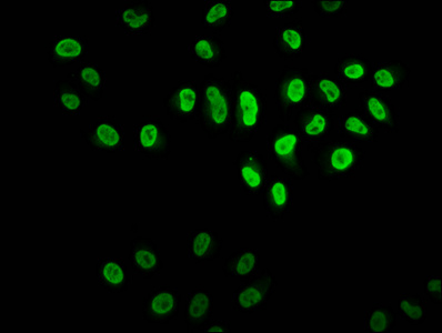 HIST1H2BN Antibody - Immunofluorescence staining of Hela cells diluted at 1:2.5, counter-stained with DAPI. The cells were fixed in 4% formaldehyde, permeabilized using 0.2% Triton X-100 and blocked in 10% normal Goat Serum. The cells were then incubated with the antibody overnight at 4°C.The Secondary antibody was Alexa Fluor 488-congugated AffiniPure Goat Anti-Rabbit IgG (H+L).