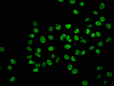 HIST1H2BN Antibody - Immunofluorescence staining of Hela cells with HIST1H2BC (Ab-12) Antibody, counter-stained with DAPI. The cells were fixed in 4% formaldehyde, permeabilized using 0.2% Triton X-100 and blocked in 10% normal Goat Serum. The cells were then incubated with the antibody overnight at 4°C. The secondary antibody was Alexa Fluor 488-congugated AffiniPure Goat Anti-Rabbit IgG(H+L).