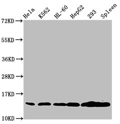 HIST1H2BN Antibody - Western Blot Positive WB detected in: Hela whole cell lysate, K562 whole cell lysate, HL-60 whole cell lysate, HepG2 whole cell lysate, 293 whole cell lysate, Rat spleen tissue All Lanes: HIST1H2BC antibody at 1.3µg/ml Secondary Goat polyclonal to rabbit IgG at 1/50000 dilution Predicted band size: 14 KDa Observed band size: 14 KDa