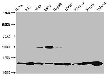 HIST1H2BN Antibody - Western Blot Positive WB detected in: Hela whole cell lysate, 293 whole cell lysate, A549 whole cell lysate, K562 whole cell lysate, HepG2 whole cell lysate, Rat liver tissue, Rat kidney tissue, Mouse brain tissue, Mouse spleen tissue All Lanes: HIST1H2BC antibody at 0.47µg/ml Secondary Goat polyclonal to rabbit IgG at 1/50000 dilution Predicted band size: 14 KDa Observed band size: 14 KDa