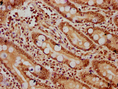 HIST1H2BN Antibody - Immunohistochemistry Dilution at 1:20 and staining in paraffin-embedded human small intestine tissue performed on a Leica BondTM system. After dewaxing and hydration, antigen retrieval was mediated by high pressure in a citrate buffer (pH 6.0). Section was blocked with 10% normal Goat serum 30min at RT. Then primary antibody (1% BSA) was incubated at 4°C overnight. The primary is detected by a biotinylated Secondary antibody and visualized using an HRP conjugated SP system.