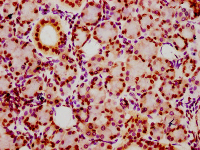 HIST1H2BN Antibody - Immunohistochemistry Dilution at 1:20 and staining in paraffin-embedded human pancreatic tissue performed on a Leica BondTM system. After dewaxing and hydration, antigen retrieval was mediated by high pressure in a citrate buffer (pH 6.0). Section was blocked with 10% normal Goat serum 30min at RT. Then primary antibody (1% BSA) was incubated at 4°C overnight. The primary is detected by a biotinylated Secondary antibody and visualized using an HRP conjugated SP system.